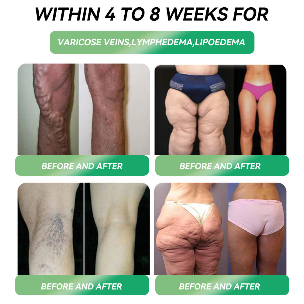 30% OFF🎁🎁𝐋𝙀𝑹𝐂𝗘𝗔® 𝑮𝗟𝐏-𝟭 Metabolic Balance Oral Ampoules👩⚕️